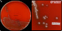 <p><strong>Fig. 282:1.</strong> Colonies of <i>Streptococcus pluranimalium</i>, cultivated aerobically on bovine blood agar during 24 h at 37°C. B shows a close-up of the plate in B. The total length of the scale bars is equivalent to 10 and 5 mm in A and B, respectively. Date: 2025-12-01.</p>