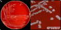 <p><strong>Fig. 102:1.</strong> Colonies of <em>Bacteroides fragilis</em>, cultivated anaerobically on a Fastidious anaerobic agar (FAA) at 37°C during 24 h. Panel A shows the whole plate and panel B shows a close-up. The total length of the scale bars are 10 and 5 mm, respectively. Date: 2026-04-07 </p>